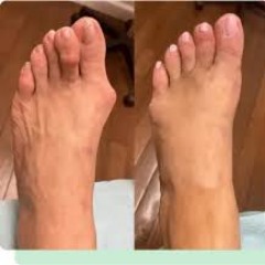Clear Wart On Foot Perth Amboy's profile picture